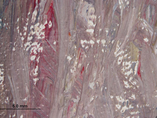Photomicrograph of the table cloth in Pissarro’s Woman Mending (1895). Dark red, translucent particles appear to be red lake. The Art Institute of Chicago, 1959.636.