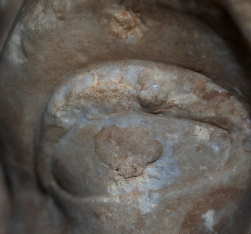 Detail showing the shallow repair to the proper right eye of Head of Mars (2nd century A.D.). The Art Institute of Chicago