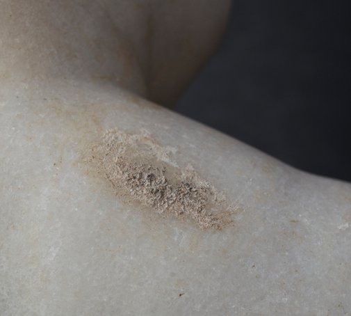 Detail showing the large patch of encrusted material on the back of the proper right shoulder of Statue of a Young Boy (1st century A.D.). The Art Institute of Chicago