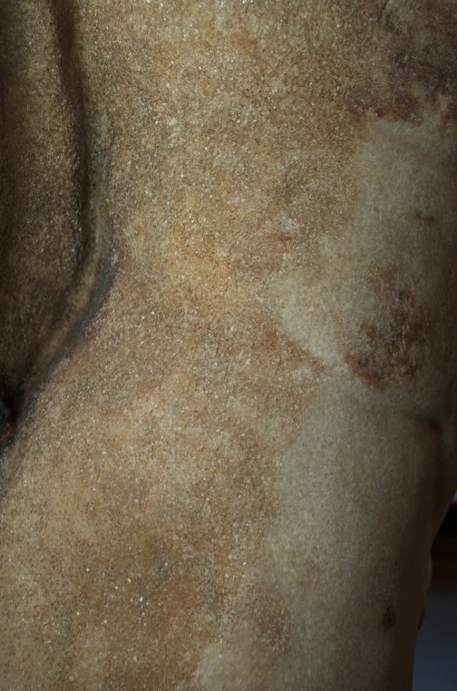 Roman Art | Online Scholarly Catalogue | Art Institute of Chicago | Detail showing the highly granulated surface on the proper right side of Fragment of a Portrait Statue of a Man (2nd century A.D.).